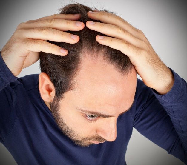 What causes alopecia?