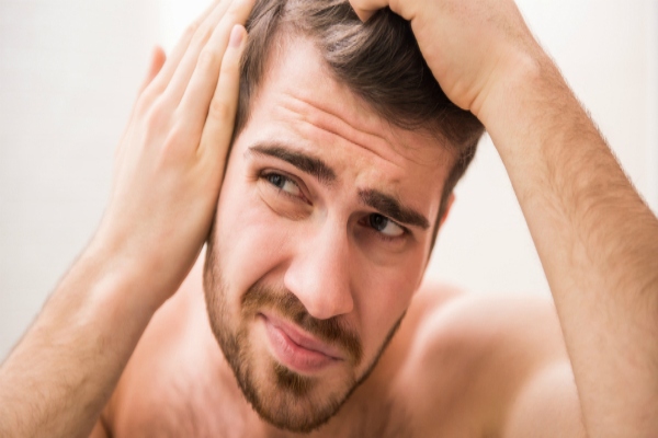 Â¿Causas de la caÃ­da del cabello en hombres?