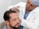 doctores de injerto capilar en España