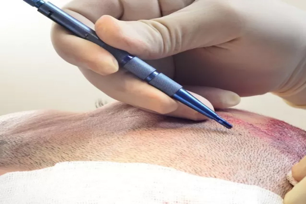 Capilclinic opiniones