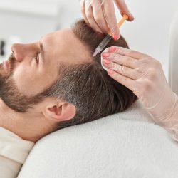 Hair Mesotherapy, What Is It?