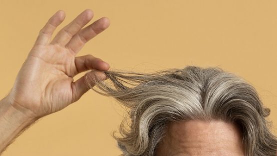 Trapianto di capelli: 10 anni dopo