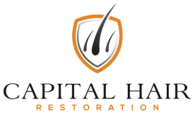 Capilar Hair restoration in London with 