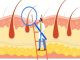 What is Hair Follicle: Its Components and Cycles of Hair Growth