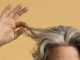 Transplante de cabelo 10 anos após a operação