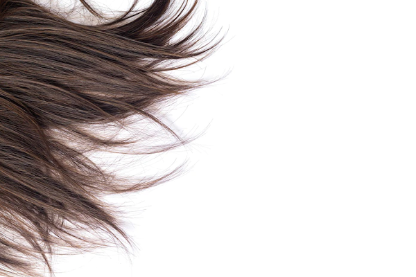 thinning hair causes