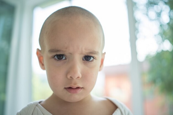 Alopecia In Children, Is It Possible