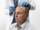 Micropigmentação capilar: o que é e tratamento