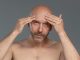 Stress ossidativo e caduta dei capelli: sono correlati?