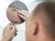 Relação entre alopecia e circulação sanguínea