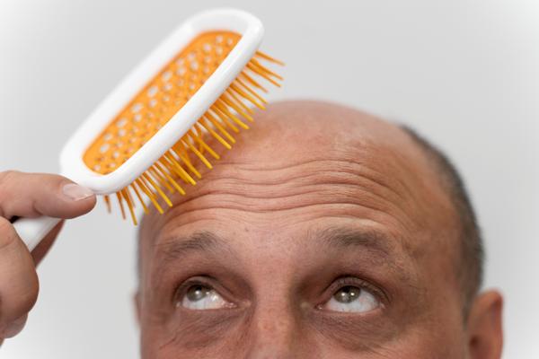 Minoxidil pastillas