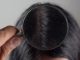 Come si manifesta la caduta dei capelli per chi ha il lupus?