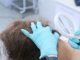 Tricologo o dermatologo? A chi dovrei rivolgermi per la caduta dei capelli ?