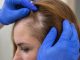 woman-getting-hair-loss-treatment-clinic