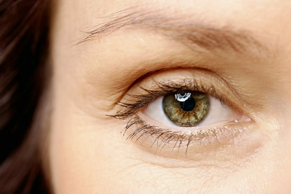 eyebrows alopecia